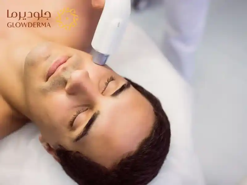 laser skin treatment